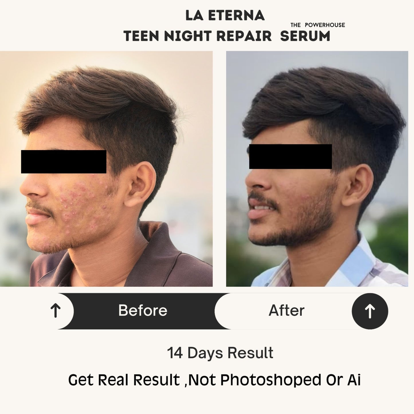 Clear Glow Teen Serum